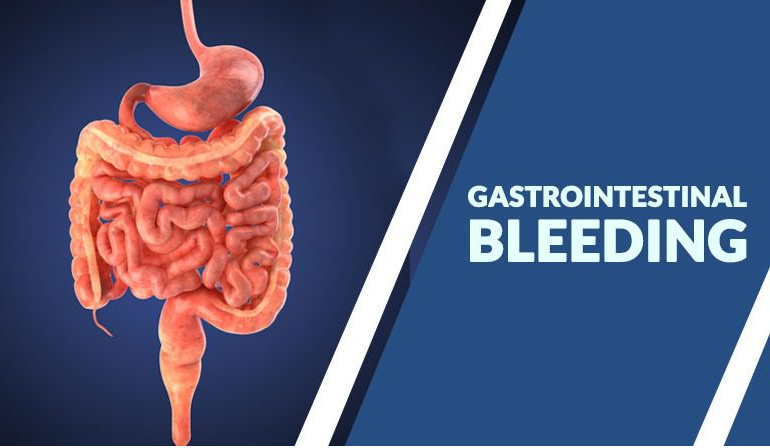 Gastrointestinal (GI) Bleeding in Children