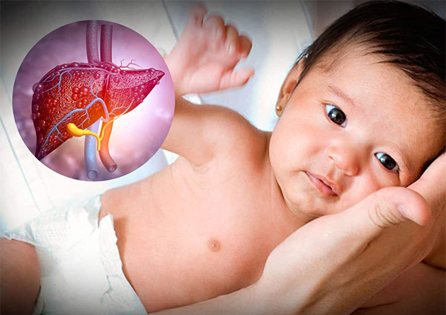 Pancreatic Disorders